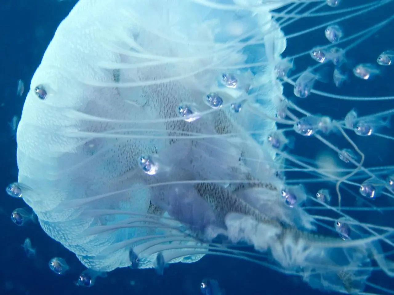 Il paziente soccombe a un'infezione da ameba mangia-cervello, come confermato dalle autorità...