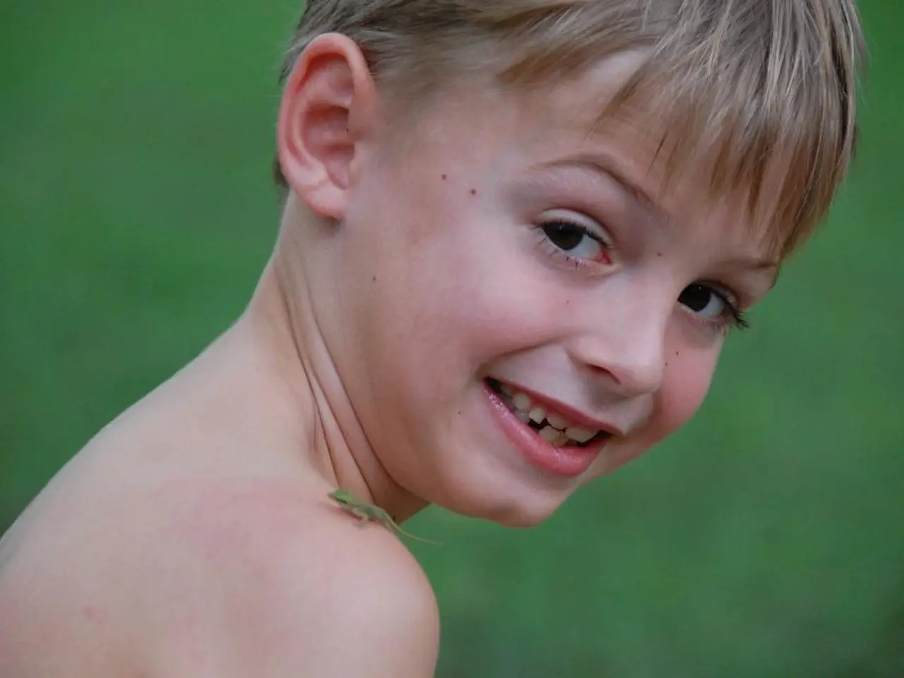 Panoramica completa della Malattia delle Tuberose, un disturbo genetico complesso che causa masse...