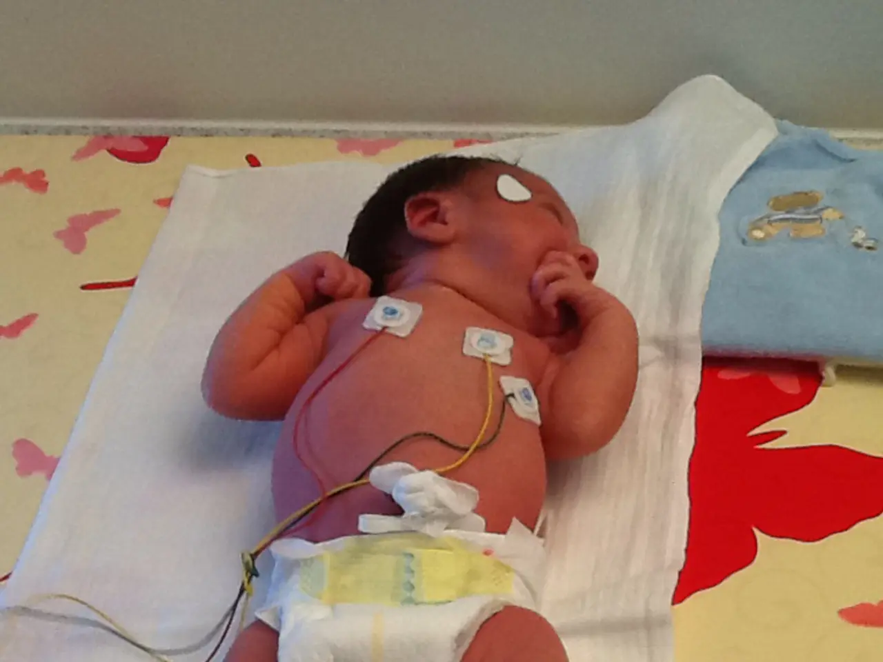 Tecnologia Ultrasuono Potenziata Migliora la Rilevazione di Malformazioni Cardiache Prenatali