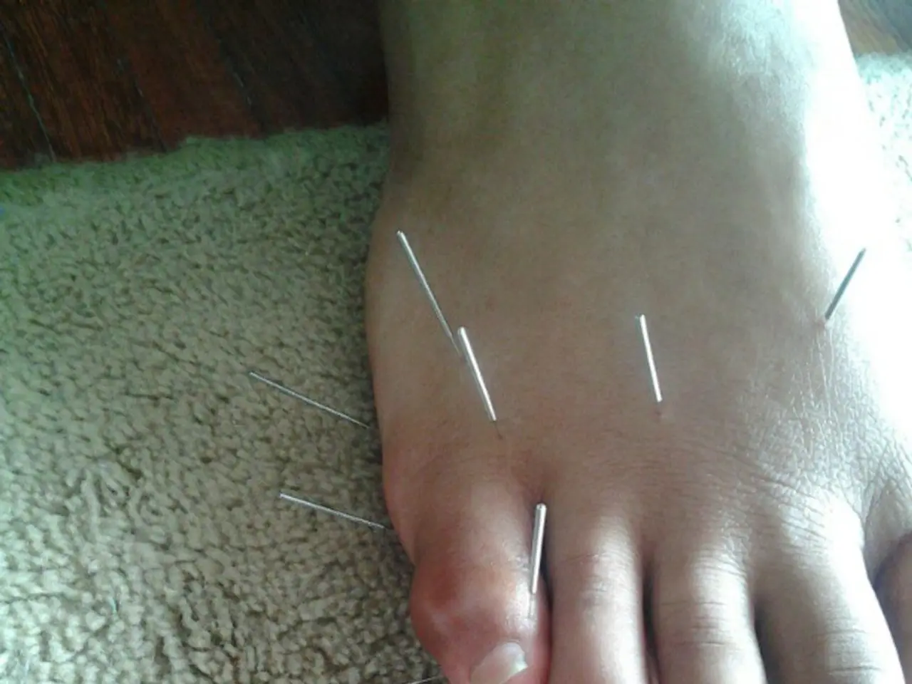 Ha subito un intervento di chirurgia estetica addominale, acquisito attraverso un annuncio di...