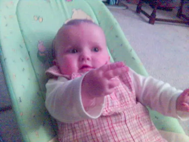 Atrofia Muscolare Spinale Infantile Tipo I: Approfondimento di una forma grave di atrofia muscolare...