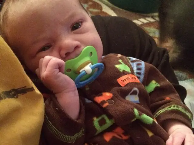 Impatto dei Seni Post-Operatori sulla Capacità di Allattamento Potenziale