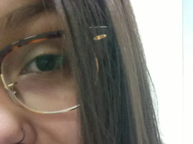 Chiarimento sulla Cataratta: Informazioni Essenziali che Ogni Paziente Dovrebbe Sapere Subito