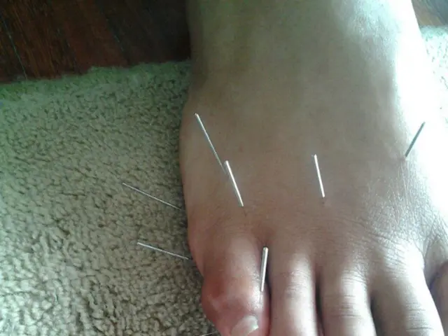 Ha subito un intervento di chirurgia estetica addominale, acquisito attraverso un annuncio di...